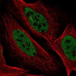 Anti-YDJC antibody produced in rabbit 