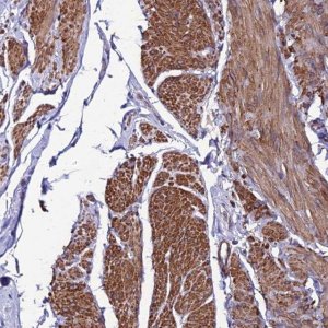 Anti-YEATS2 antibody produced in rabbit 