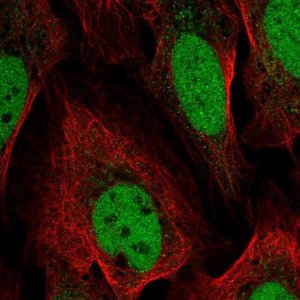 Anti-YEATS4 antibody produced in rabbit 