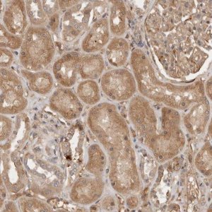 Anti-YES1 antibody produced in rabbit 