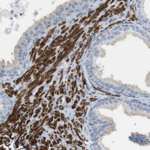 Anti-YIF1A antibody produced in rabbit 