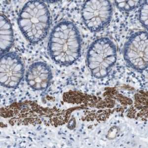 Anti-YIF1A antibody produced in rabbit 