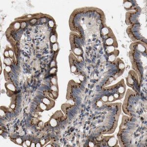 Anti-YIPF4 antibody produced in rabbit 
