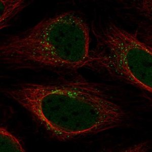 Anti-YIPF5 antibody produced in rabbit 