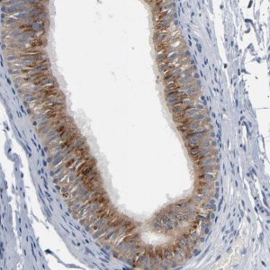 Anti-YIPF6 antibody produced in rabbit 