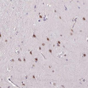 Anti-YLPM1 antibody produced in rabbit 