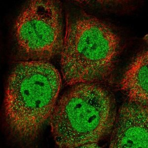 Anti-YLPM1 antibody produced in rabbit 
