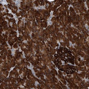 Anti-YRDC antibody produced in rabbit 