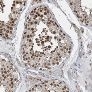 Anti-YTHDC1 antibody produced in rabbit 