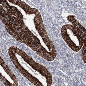 Anti-YTHDC2 antibody produced in rabbit 