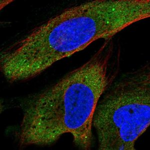 Anti-YTHDF2 antibody produced in rabbit 