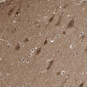Anti-YWHAB antibody produced in rabbit HPA007925-100UL