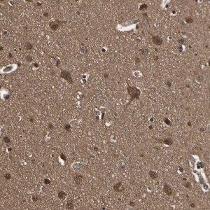 Anti-YWHAE antibody produced in rabbit 