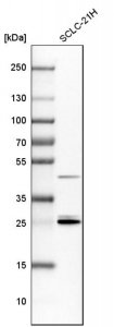 Anti-YWHAE antibody produced in rabbit 