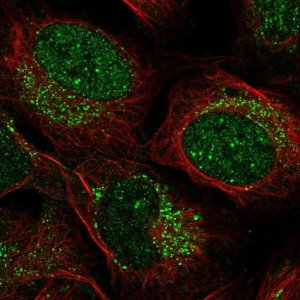Anti-ZADH2 antibody produced in rabbit 