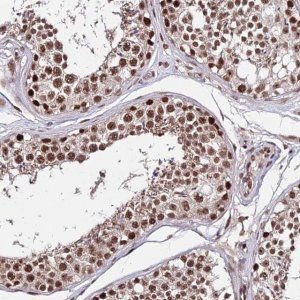 Anti-ZBED4 antibody produced in rabbit HPA045341-100UL