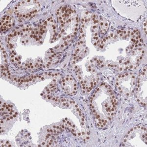 Anti-ZBED5 antibody produced in rabbit 