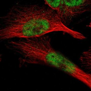 Anti-ZBTB11 antibody produced in rabbit 