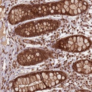 Anti-ZBTB12 antibody produced in rabbit 