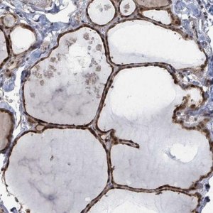 Anti-ZBTB14 antibody produced in rabbit 