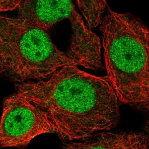 Anti-ZBTB14 antibody produced in rabbit 