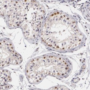 Anti-ZBTB16 antibody produced in rabbit 