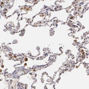Anti-ZBTB16 antibody produced in rabbit 