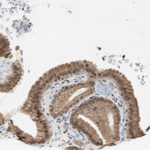 Anti-ZBTB17 antibody produced in rabbit 