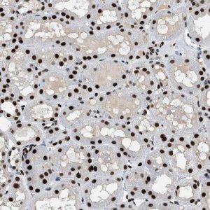 Anti-ZBTB20 antibody produced in rabbit 