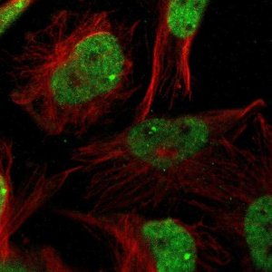 Anti-ZBTB20 antibody produced in rabbit 