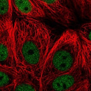 Anti-ZBTB21 antibody produced in rabbit 
