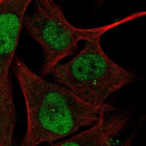 Anti-ZBTB24 antibody produced in rabbit 