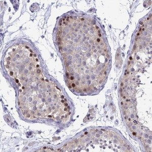Anti-ZBTB25 antibody produced in rabbit 
