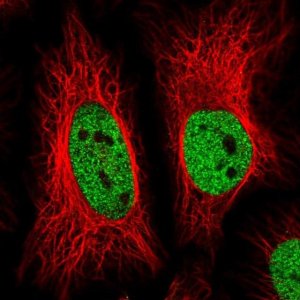 Anti-ZBTB25 antibody produced in rabbit 