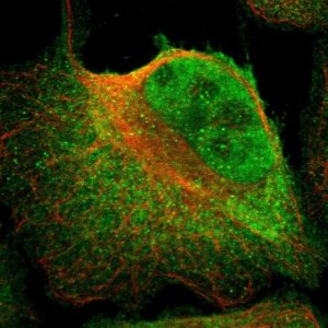 Anti-ZBTB33 antibody produced in rabbit 
