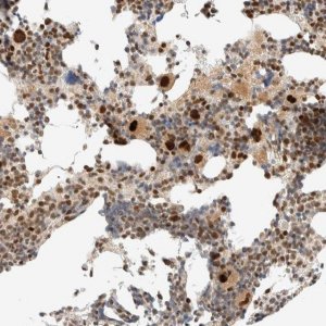 Anti-ZBTB34 antibody produced in rabbit 