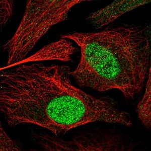 Anti-ZBTB34 antibody produced in rabbit 