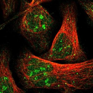 Anti-ZBTB37 antibody produced in rabbit 