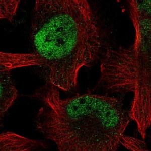 Anti-ZBTB38 antibody produced in rabbit 