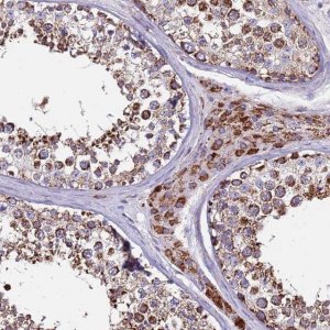 Anti-ZBTB39 antibody produced in rabbit 