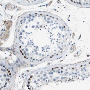 Anti-ZBTB43 antibody produced in rabbit 