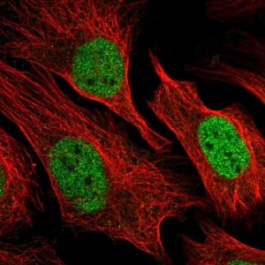 Anti-ZBTB44 antibody produced in rabbit 