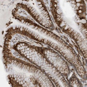 Anti-ZBTB45 antibody produced in rabbit 