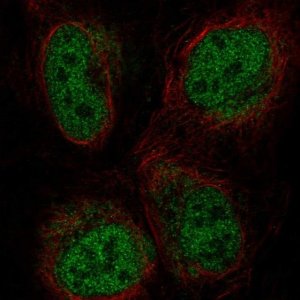 Anti-ZBTB47 antibody produced in rabbit 