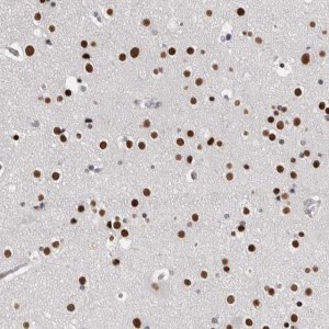 Anti-ZBTB49 antibody produced in rabbit 