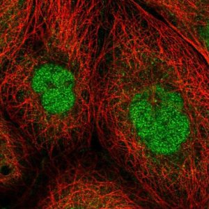 Anti-ZBTB49 antibody produced in rabbit 