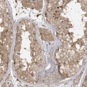 Anti-ZBTB8A antibody produced in rabbit 