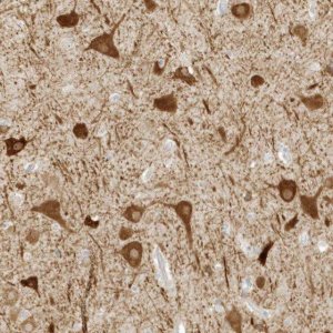 Anti-ZBTB8A antibody produced in rabbit 