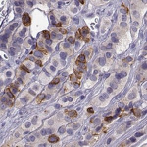 Anti-ZBTB8B antibody produced in rabbit 