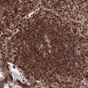 Anti-ZBTB8OS antibody produced in rabbit 